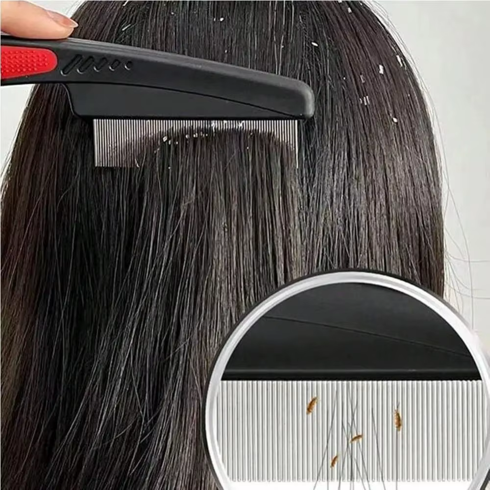 Peigne anti-lentes à poignée antidérapante, à dents fines, pour éliminer les pellicules et les puces sans douleur, peigne nettoyant pour le cuir chevelu, peigne à cheveux