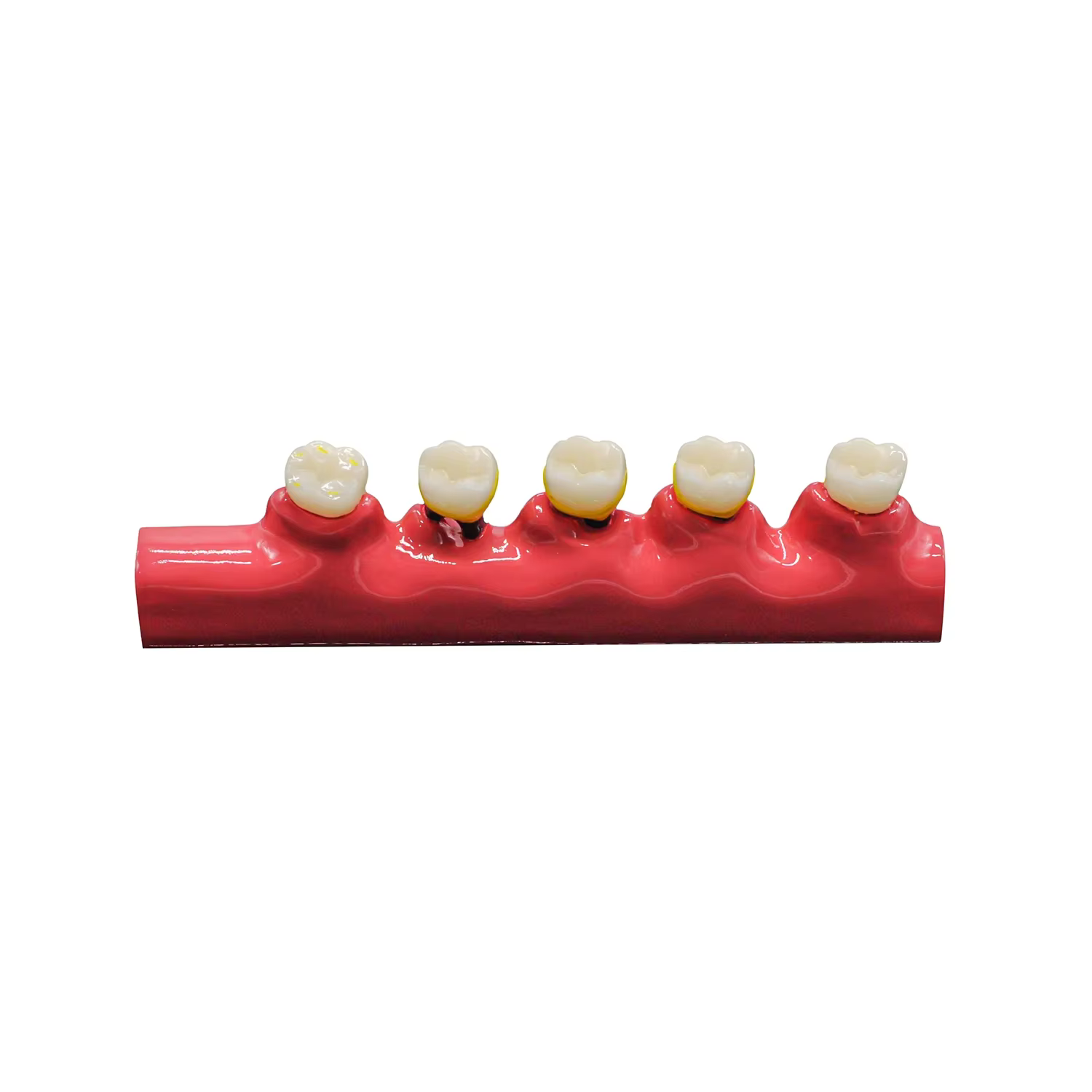 1PC étude dentaire modèle d'enseignement maladies parodontales assortiment dents Dentoform Typodont pour les étudiants dentistes étudiant enseignement