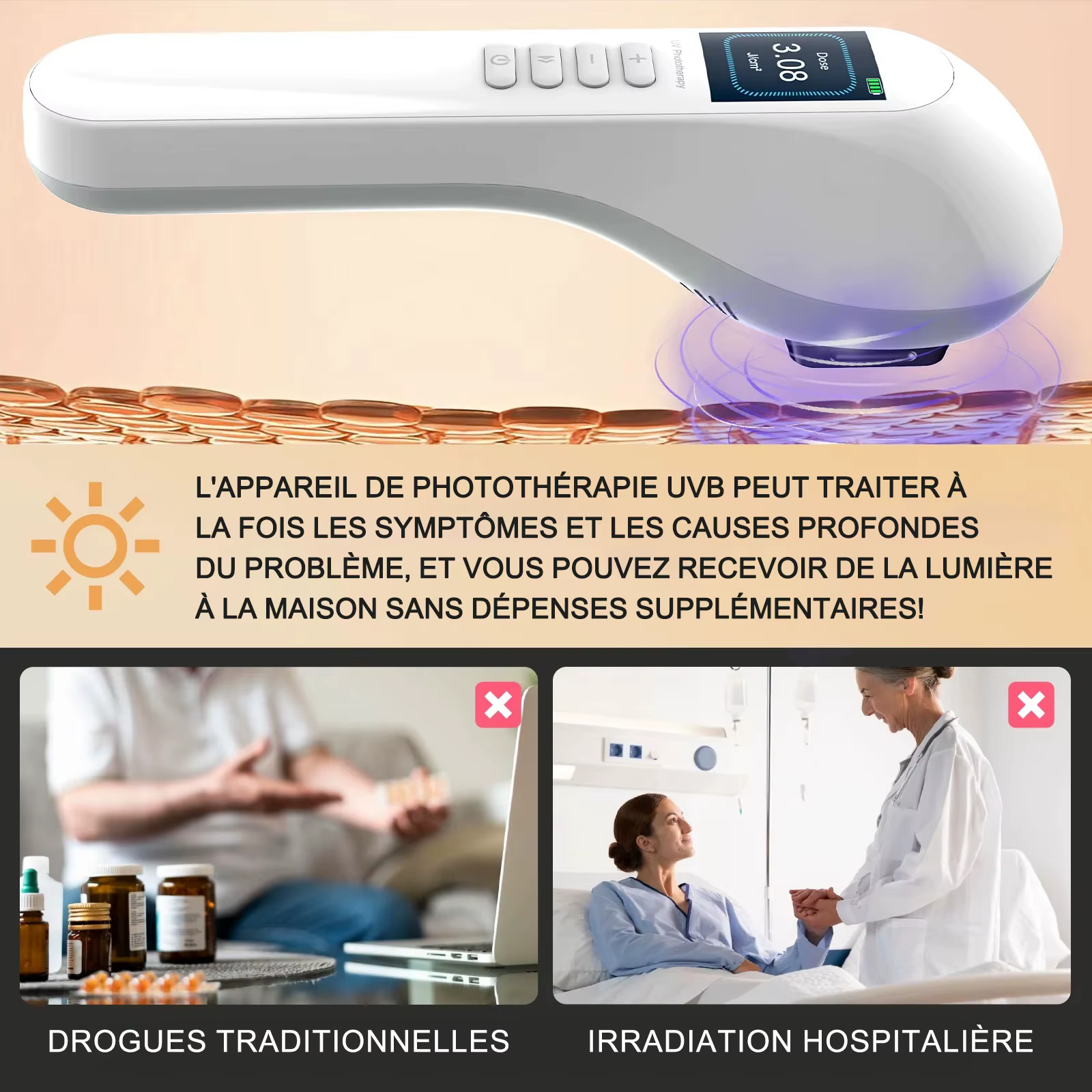 Lampe de photothérapie KTS pour traitement du vitiligo, bande étroite UV, thérapie par la lumière ultraviolette, taches de psoriasis, eczégypti, 308NM
