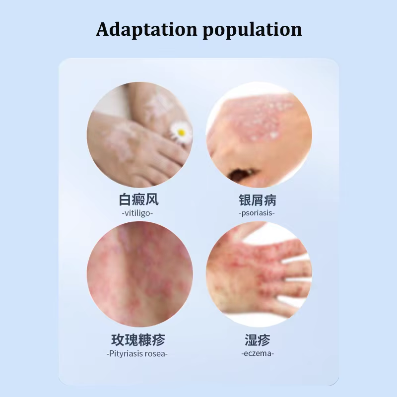 Lampe de photothérapie UVB 311nm, dispositif pour le traitement du Vitiligo, thérapie à la lumière ultraviolette UV à bande étroite, taches de Psoriasis, eczéma