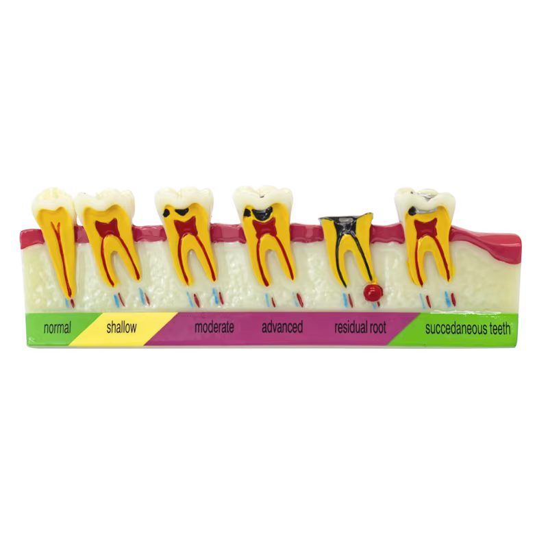 Modèle de dent de maladie dentaire, fuchsia dentaire, dentiste, formation, apprentissage, communication médecin-patient