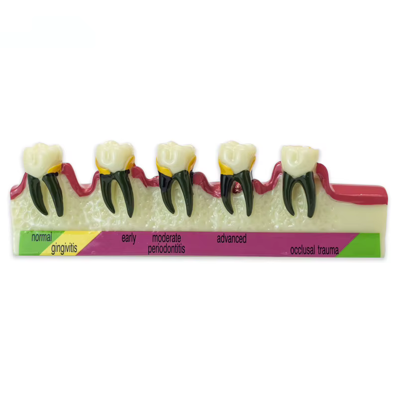 Modèle de dent de maladie dentaire, fuchsia dentaire, dentiste, formation, apprentissage, communication médecin-patient