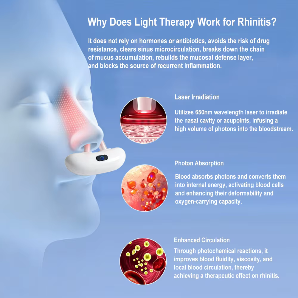 Appareil de thérapie nasale à lumière rouge intelligent pour la rhinite chronique, soin du nez qui coule et qui démange, soulagement de la rhinite, physiothérapie, ventilation nasale